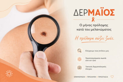 πρόληψη μελανώματος