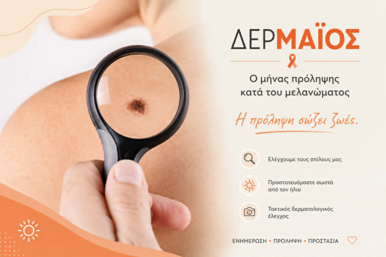 πρόληψη μελανώματος